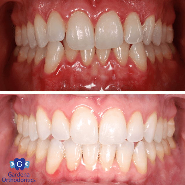Gardena Orthodontics photo