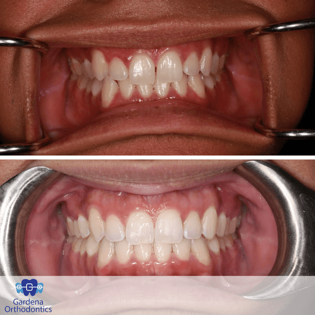 Gardena Orthodontics photo