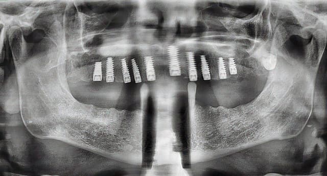 Torrance Oral Surgery Center photo