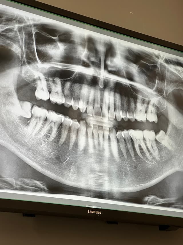 Torrance Oral Surgery Center photo