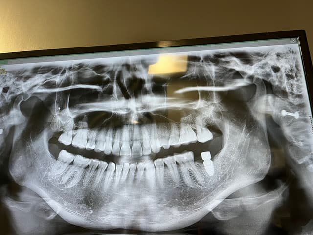 Torrance Oral Surgery Center photo