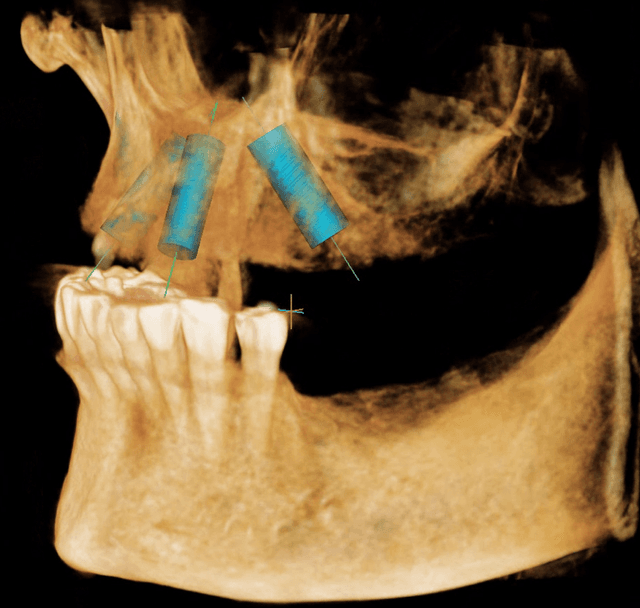 Torrance Oral Surgery Center photo
