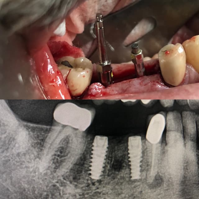 Torrance Oral Surgery Center photo