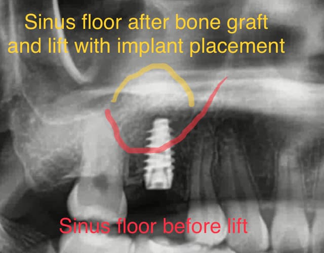 Torrance Oral Surgery Center photo