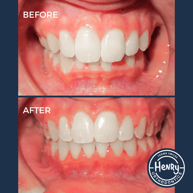 Henry Advanced Orthodontics photo