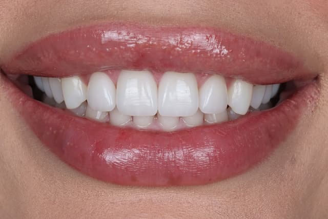 Stunning Smiles of Las Vegas photo