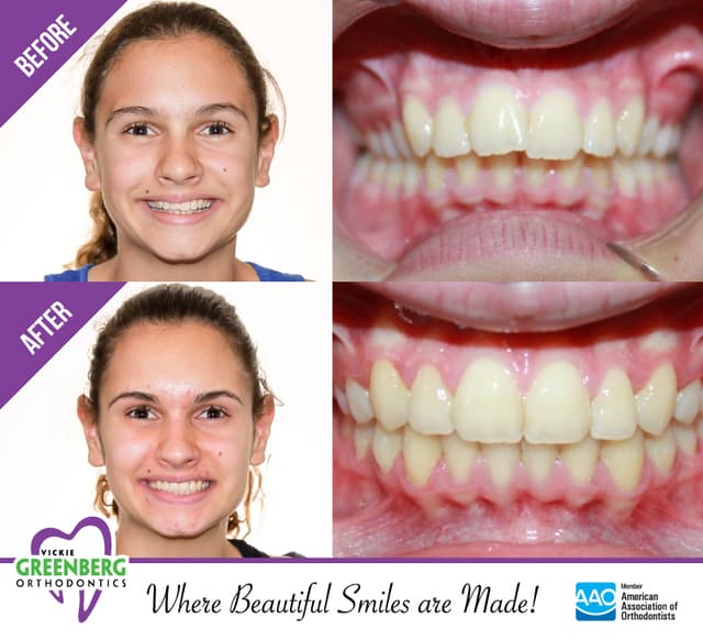 Greenberg Orthodontics, TMJ & Airway photo