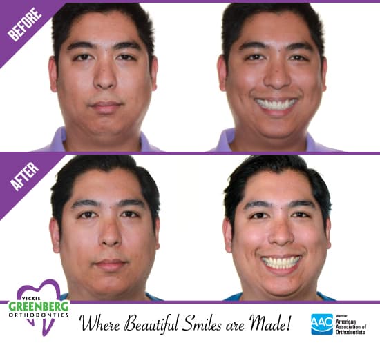 Greenberg Orthodontics, TMJ & Airway photo