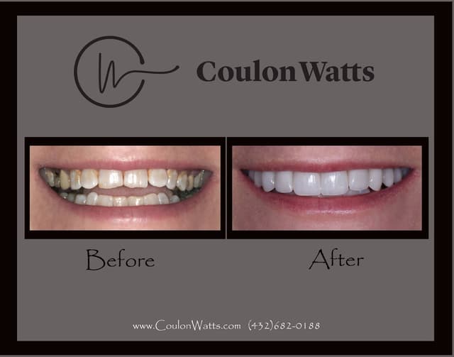 Coulon Watts photo