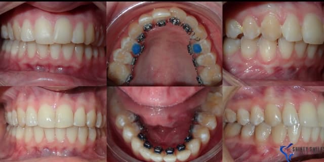 Shiney Smiles Orthodontics photo