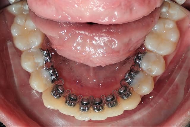 Shiney Smiles Orthodontics photo