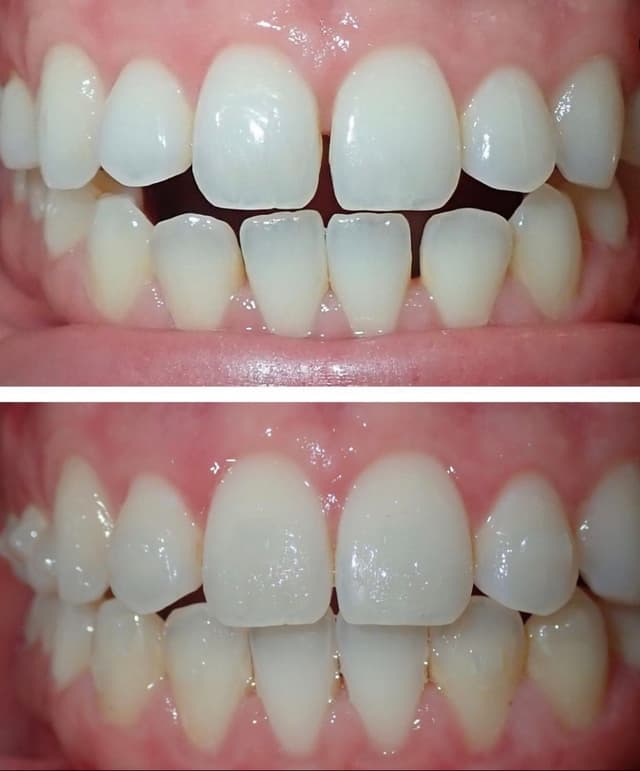 Shiney Smiles Orthodontics photo