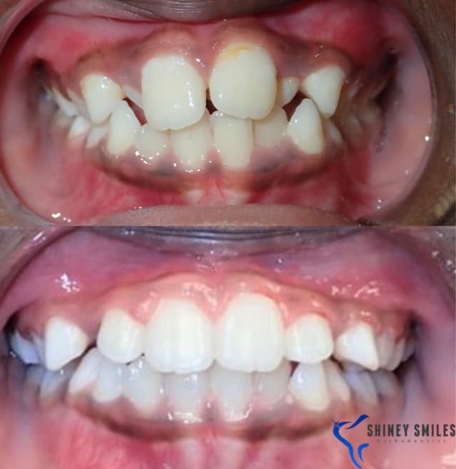 Shiney Smiles Orthodontics photo