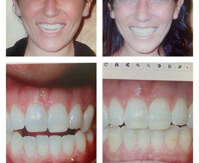 Shiney Smiles Orthodontics photo