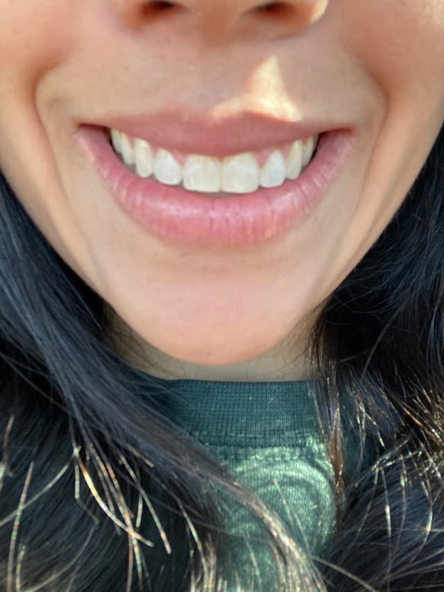 Smiles Orthodontics photo