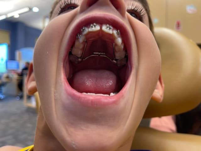 Bankhead Orthodontic Specialists photo