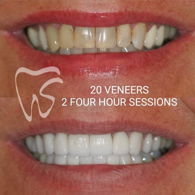 Stanton Smiles photo