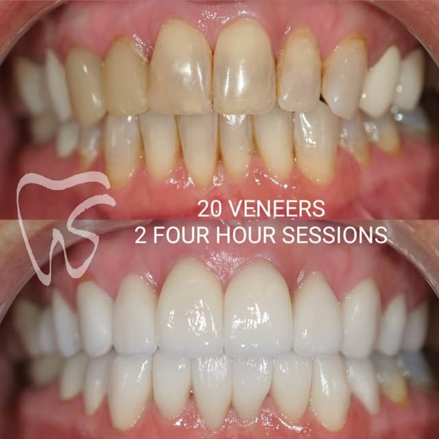 Stanton Smiles photo