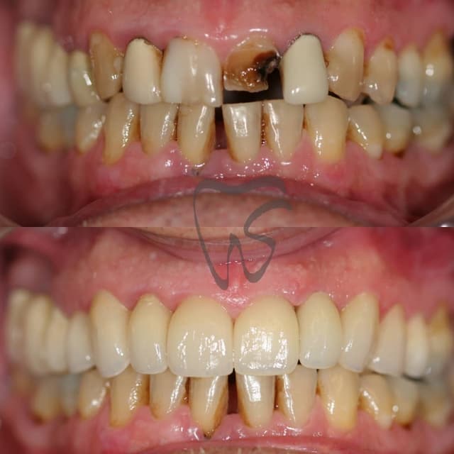 Stanton Smiles photo
