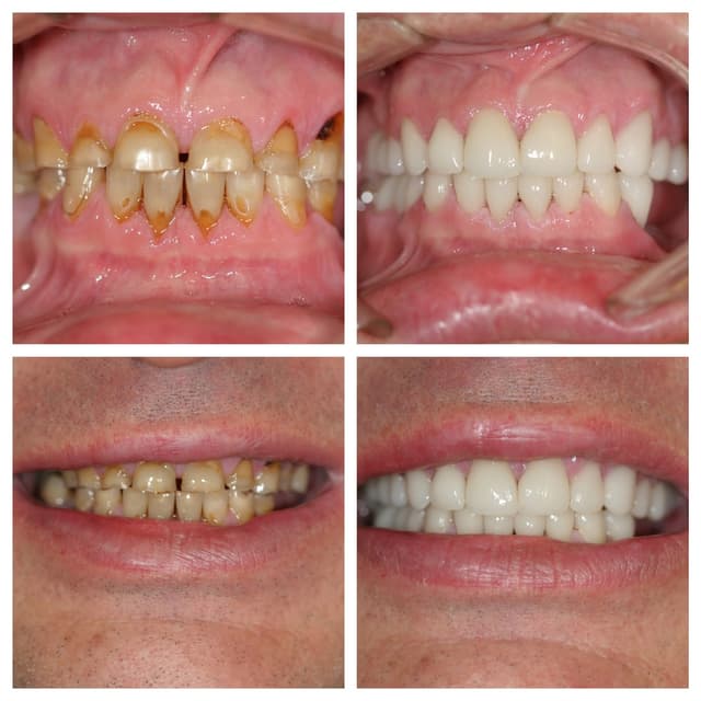 Stanton Smiles photo
