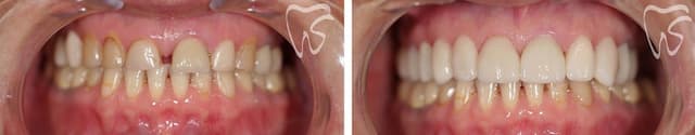 Stanton Smiles photo