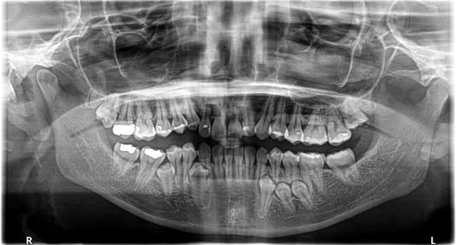 Oral Facial Reconstruction and Implant Center - Plantation photo