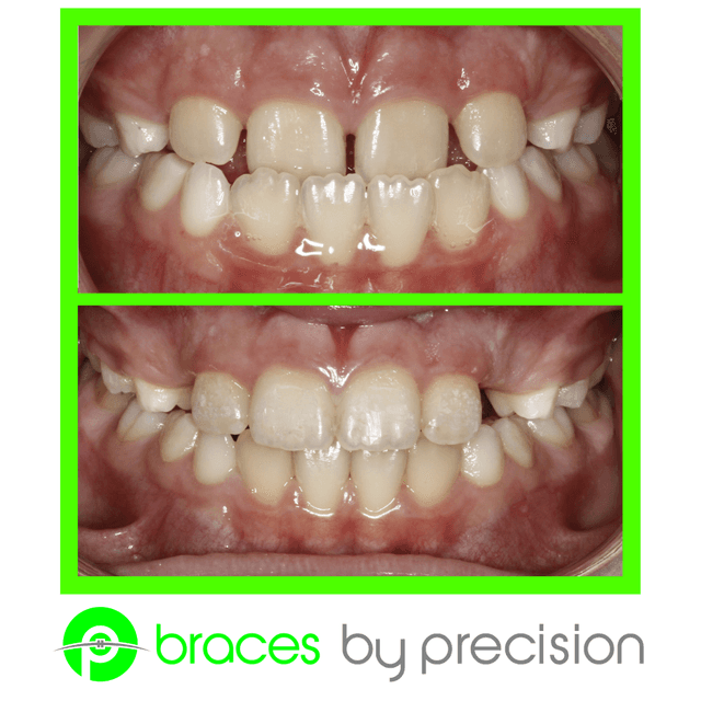 Precision Orthodontics photo