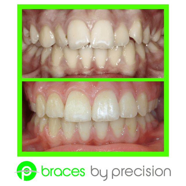 Precision Orthodontics photo
