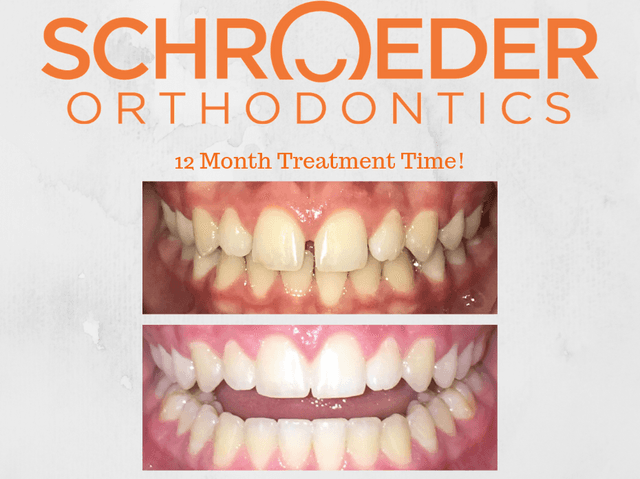 Schroeder Orthodontics photo