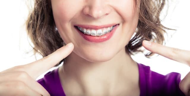 Top Smile Orthodontics - SUNNYVALE photo