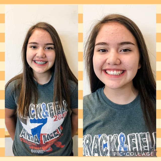 Smile Straight Orthodontics - Midland photo