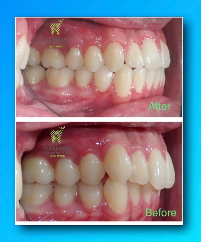 Gardens Orthodontics photo