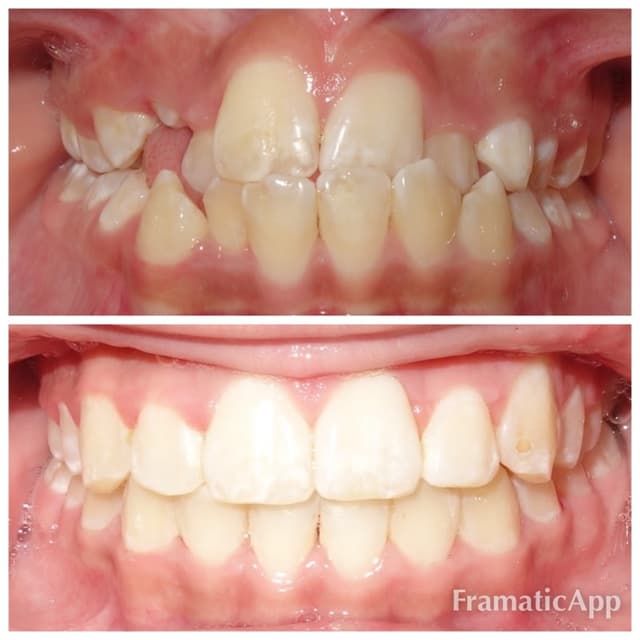 Patino Orthodontics photo
