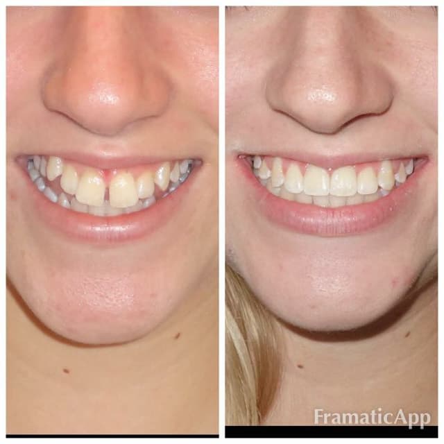 Patino Orthodontics photo
