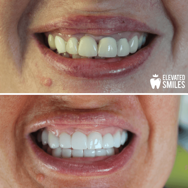 Elevated Smiles photo