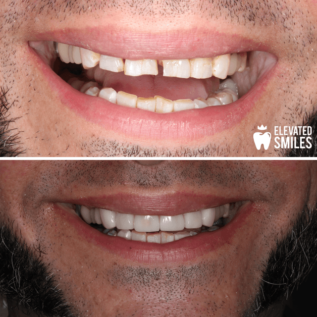 Elevated Smiles photo
