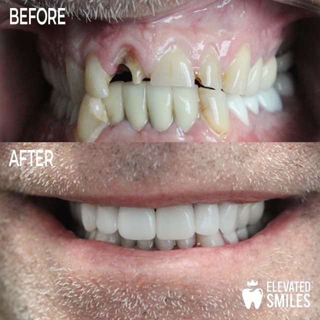 Elevated Smiles photo