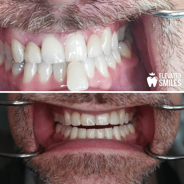 Elevated Smiles photo