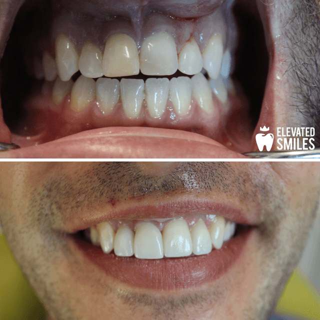 Elevated Smiles photo