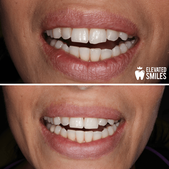 Elevated Smiles photo