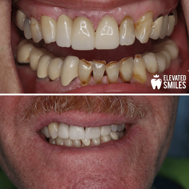 Elevated Smiles photo