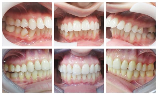 Blooming Braces photo