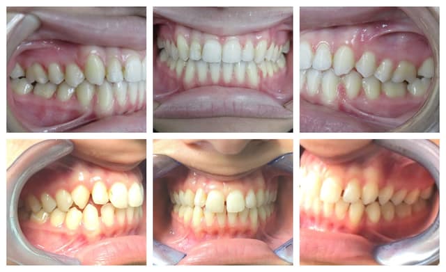 Blooming Braces photo