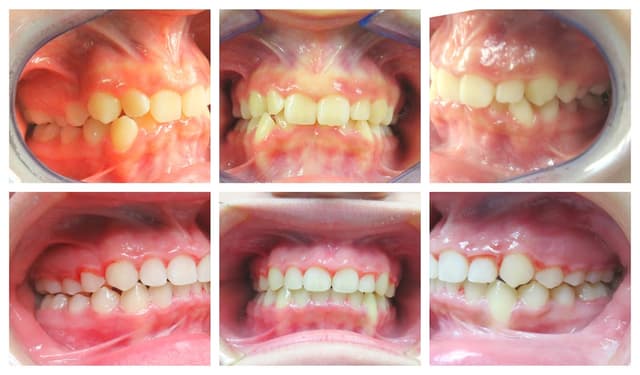 Blooming Braces photo