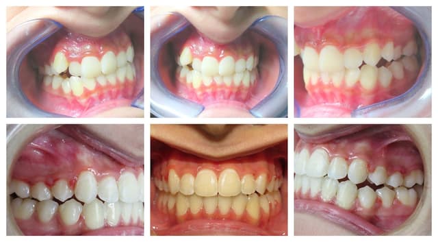 Blooming Braces photo