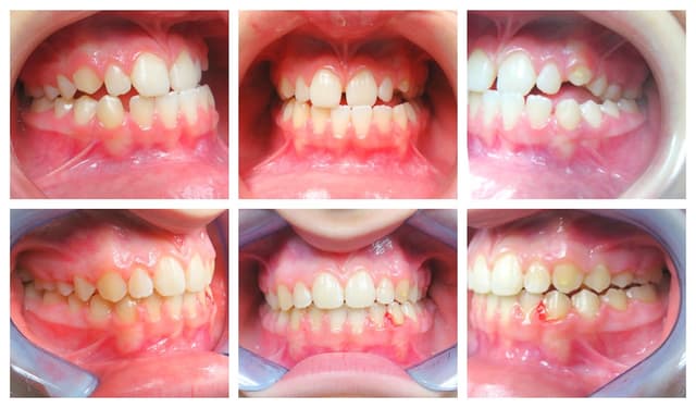 Blooming Braces photo