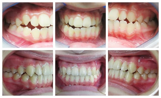 Blooming Braces photo