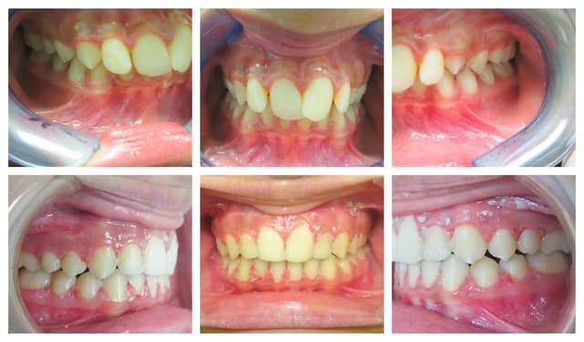 Blooming Braces photo