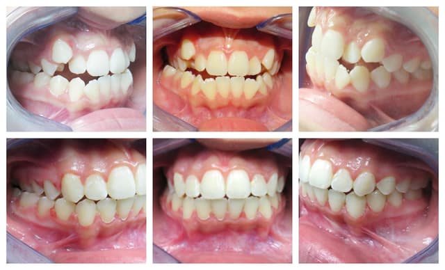 Blooming Braces photo