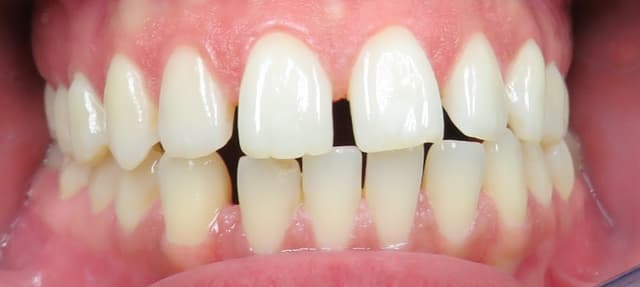 Blooming Braces photo